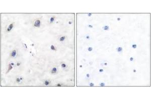 Immunohistochemistry analysis of paraffin-embedded human brain tissue, using DARPP-32 (Ab-34) Antibody. (DARPP32 Antikörper  (AA 18-67))