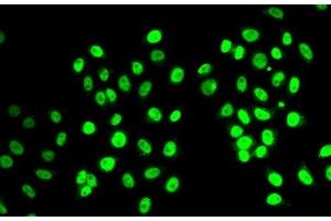 Immunofluorescence analysis of MCF-7 cells using REST Polyclonal Antibody (REST Antikörper)