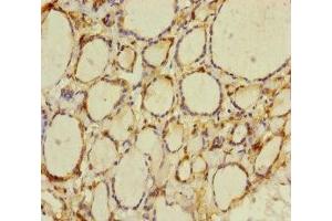 Immunohistochemistry of paraffin-embedded human thyroid tissue using ABIN7165198 at dilution of 1:100 (CRBN Antikörper  (AA 1-280))