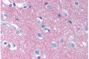 Human Brain, Cortex (formalin-fixed, paraffin-embedded) stained with NCAM1 antibody ABIN239830 at 10 µg/ml followed by biotinylated anti-mouse IgG secondary antibody ABIN481714, alkaline phosphatase-streptavidin and chromogen. (CD56 Antikörper)