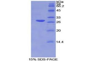 SDS-PAGE analysis of Mouse GSTm2 Protein.
