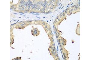 Immunohistochemistry of paraffin-embedded Human prostate using GPI Polyclonal Antibody at dilution of 1:100 (40x lens). (GPI Antikörper)