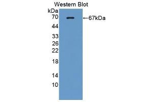 Western blot analysis of the recombinant protein. (Lactate Dehydrogenase A Antikörper  (AA 1-332))