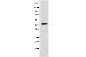 Western blot analysis IFI-56K using LOVO whole cell lysates (IFIT1 Antikörper  (Internal Region))