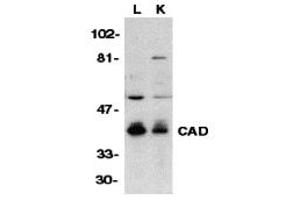 Western Blotting (WB) image for anti-Carbamoyl-Phosphate Synthetase 2, Aspartate Transcarbamylase, and Dihydroorotase (CAD) (C-Term) antibody (ABIN1030307) (CAD Antikörper  (C-Term))