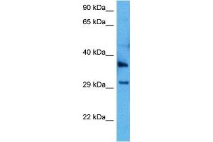 Western Blotting (WB) image for anti-Gap Junction Protein, beta 1, 32kDa (GJB1) (C-Term) antibody (ABIN2774855)