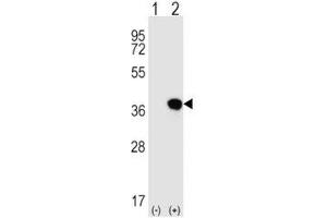 Western blot analysis of HLA-G antibody and 293 cell lysate either nontransfected (Lane 1) or transiently transfected (2) with the HLA-G gene.