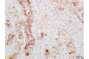 Formalin-fixed and paraffin embedded mouse thyroid labeled with Anti-Secretin receptor Polyclonal Antibody, Unconjugated (ABIN724730) at 1:200 followed by conjugation to the secondary antibody and DAB staining (SCTR Antikörper  (AA 188-280))