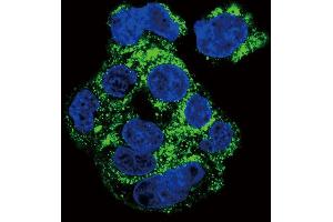 Confocal immunofluorescent analysis of CSF1R Antibody (ABIN652364 and ABIN2841700) with HepG2 cell followed by Alexa Fluor 488-conjugated goat anti-rabbit lgG (green). (CSF1R Antikörper)