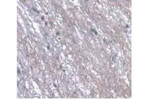 Detection of LRG1 in Rat Spinal Cord Tissue using Monoclonal Antibody to Leucine Rich Alpha-2-Glycoprotein 1 (LRG1) (LRG1 Antikörper  (AA 154-332))