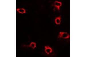 Immunofluorescent analysis of ACP5 staining in U2OS cells. (ACP5 Antikörper)