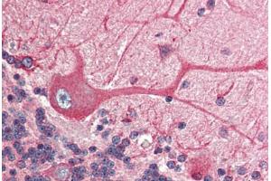 Human Brain, Cerebellum (formalin-fixed, paraffin-embedded) stained with BCAP31 antibody ABIN305788 at 2. (BCAP31 Antikörper  (C-Term))