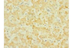Immunohistochemistry of paraffin-embedded human liver tissue using ABIN7161009 at dilution of 1:100 (NOX3 Antikörper  (AA 223-395))