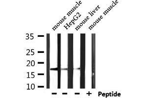 Western blot analysis of extracts from mouse muscle ,HepG2,mouse liver, using KLRC2/4 Antibody. (KLRC2/4 Antikörper)