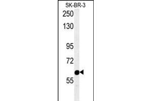 RADIL Antibody (C-term) (ABIN654195 and ABIN2844045) western blot analysis in SK-BR-3 cell line lysates (15 μg/lane). (Radil Antikörper  (C-Term))