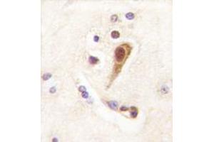 Image no. 1 for anti-LIM Homeobox 6 (LHX6) (N-Term) antibody (ABIN356903)