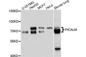 Western blot analysis of extracts of various cell lines, using PICALM antibody (ABIN4904757) at 1:1000 dilution. (PICALM Antikörper)