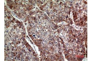 Immunohistochemistry (IHC) analysis of paraffin-embedded Human Lung, antibody was diluted at 1:100. (IL-24 Antikörper  (Internal Region))