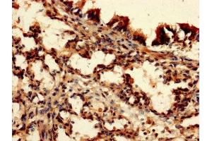 IHC image of ABIN7149549 diluted at 1:150 and staining in paraffin-embedded human lung tissue performed on a Leica BondTM system. (DAP Antikörper  (AA 2-102))