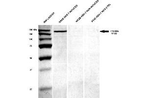 Western Blotting (WB) image for anti-Glutamate Receptor, Ionotropic, N-Methyl D-Aspartate 2B (GRIN2B) (AA 20-271) antibody (APC) (ABIN2483215)