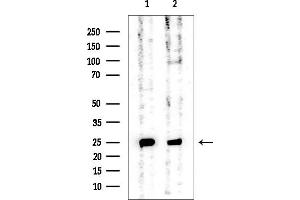 Western blot analysis of lysates from various samples, using GSTP1 Mouse Monoclonal Antibody at 1/1000 dilution.