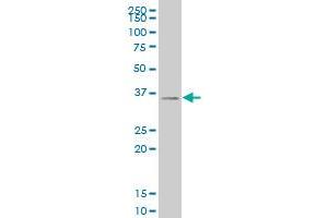 SIX3 monoclonal antibody (M04), clone 1A2 Western Blot analysis of SIX3 expression in 293 . (SIX3 Antikörper  (AA 273-332))