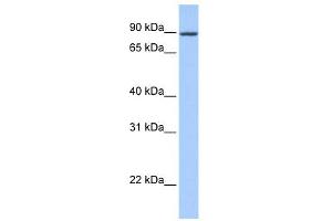WB Suggested Anti-ZNF16 Antibody Titration:  0.