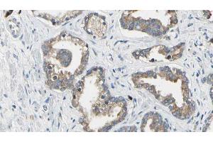ABIN6268698 at 1/100 staining Human prostate tissue by IHC-P. (CD51 Antikörper  (Internal Region))
