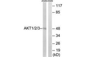 Western blot analysis of extracts from A549 cells, using AKT1/2/3 (Ab-315/316/312) Antibody. (AKT 1/2/3 Antikörper  (AA 281-330))