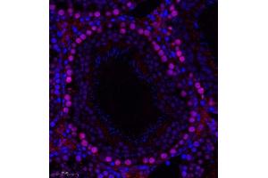 Immunofluorescence (Paraffin-embedded Sections) (IF (p)) image for anti-PHD Finger Protein 10 (PHF10) antibody (ABIN7075029)