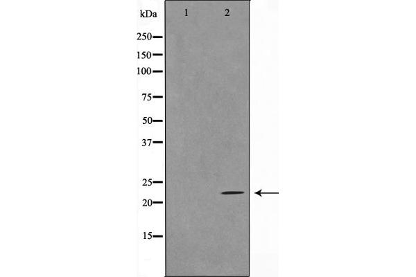 TNFSF13 Antikörper  (Internal Region)