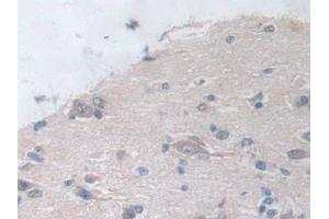 Immunohistochemistry (IHC) image for anti-Suppressor of Cytokine Signaling 2 (SOCS2) (AA 1-198) antibody (ABIN7443314)