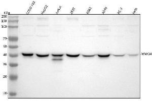 Western blot analysis of WWOX using anti-WWOX antibody (ABIN5693294). (WWOX Antikörper  (AA 1-245))