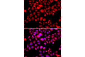 Immunofluorescence analysis of A549 cell using ETFA antibody. (ETFA Antikörper)