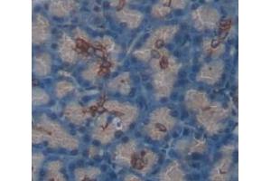 IHC-P analysis of Human Tissue, with DAB staining. (SEMA4B Antikörper  (AA 644-832))