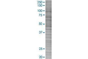 STK33 transfected lysate. (STK33 293T Cell Transient Overexpression Lysate(Denatured))