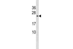 Western Blotting (WB) image for anti-Protein CutA (CUTA) antibody (ABIN3004522) (CUTA Antikörper)