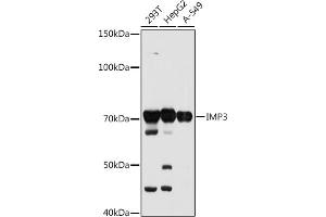 Western blot analysis of extracts of various cell lines, using IMP3 antibody (ABIN7267904) at 1:1000 dilution. (IGF2BP3 Antikörper)