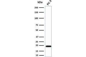 Western Blot Analysis of PC-3 cell lysate using NME2 / nm23-H2 Mouse Monoclonal Antibody (CPTC-NME2-2).