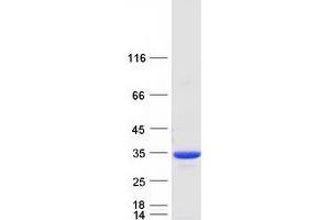 Western Blotting (WB) image for NAD(P)H Dehydrogenase, Quinone 1 (NQO1) (Transcript Variant 1) protein (Myc-DYKDDDDK Tag) (ABIN2727519)