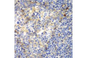 Immunohistochemistry of paraffin-embedded human amygdalitis using ZAP70 antibody. (ZAP70 Antikörper  (AA 1-300))