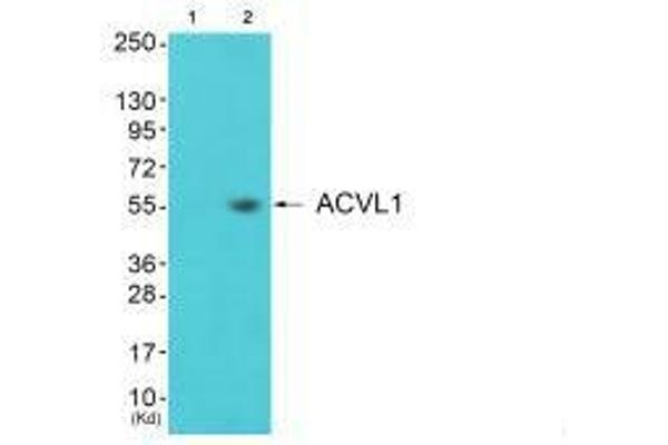 ACVRL1 抗体