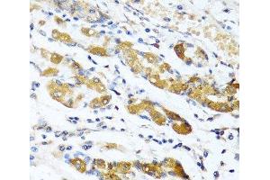 Immunohistochemistry of paraffin-embedded Human stomach using OGN Polyclonal Antibody at dilution of 1:100 (40x lens). (OGN Antikörper)
