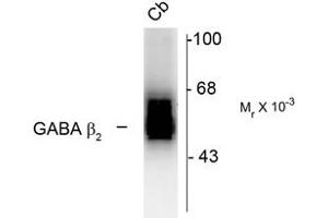 Image no. 2 for anti-gamma-aminobutyric Acid (GABA) A Receptor, beta 2 (GABRB2) (Cytoplasmic Domain) antibody (ABIN228403) (GABRB2 Antikörper  (Cytoplasmic Domain))