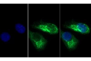 Detection of KRT33A in Human Hela cell using Polyclonal Antibody to Keratin 33A (KRT33A) (Keratin 33A Antikörper  (AA 57-363))