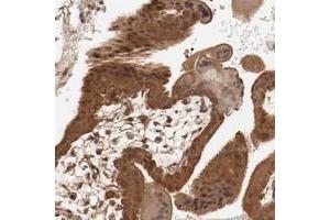 Immunohistochemical staining of human placenta with PITPNM2 polyclonal antibody  shows strong cytoplasmic and nuclear positivity in trophoblastic cells at 1:20-1:50 dilution. (PITPNM2 Antikörper)