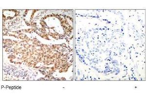 Image no. 1 for anti-Myocyte Enhancer Factor 2A (MEF2A) (pSer408) antibody (ABIN197080) (MEF2A Antikörper  (pSer408))