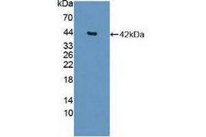 Figure. (HDAC9 Antikörper  (AA 23-343))
