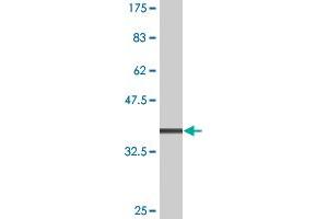 Western Blot detection against Immunogen (36. (Casein Kinase 1 gamma 2 Antikörper  (AA 315-415))