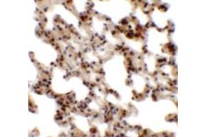 Immunohistochemistry of Coronin 7 in rat lung tissue with Coronin 7 antibody at 2.